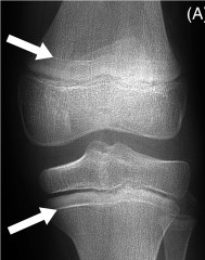Key image 2