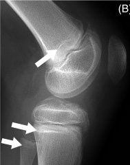 Key image 3