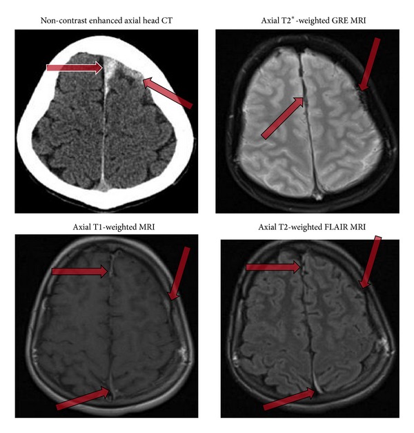 Key image 1