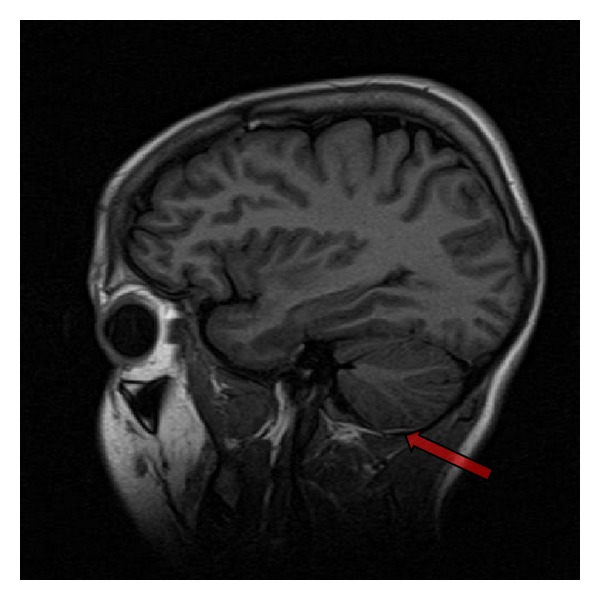 Key image 2