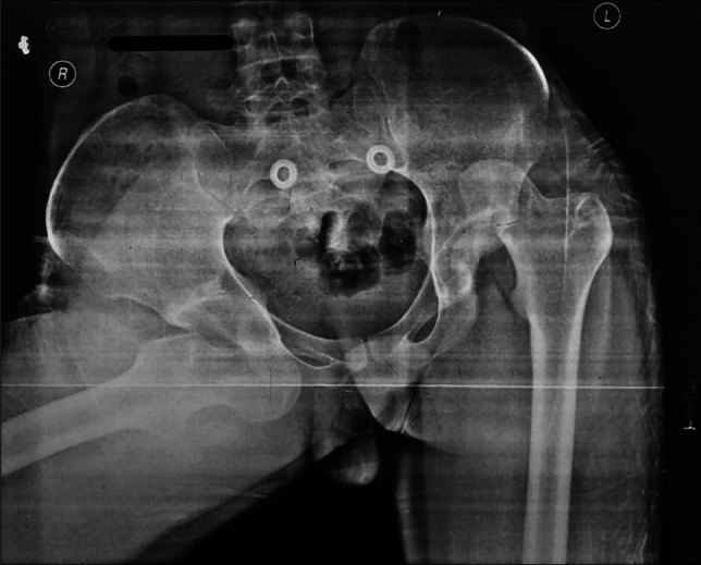Key image 1