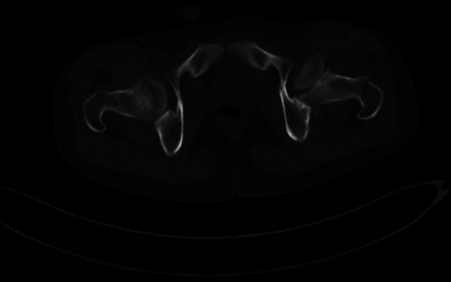 Key image 2