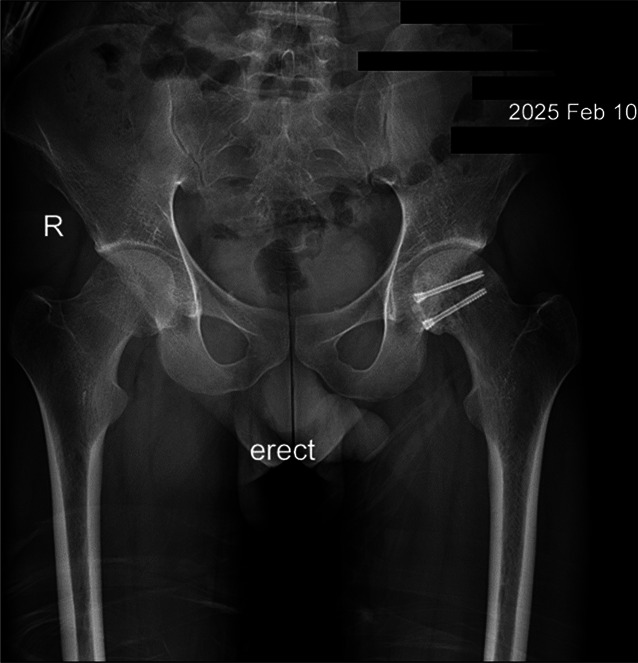 Key image 3