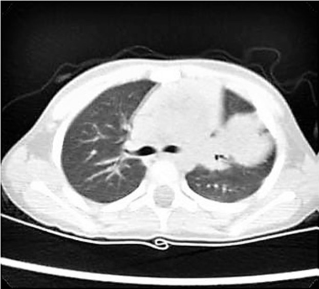 Key image 1