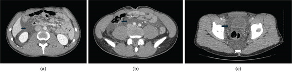 Key image 1