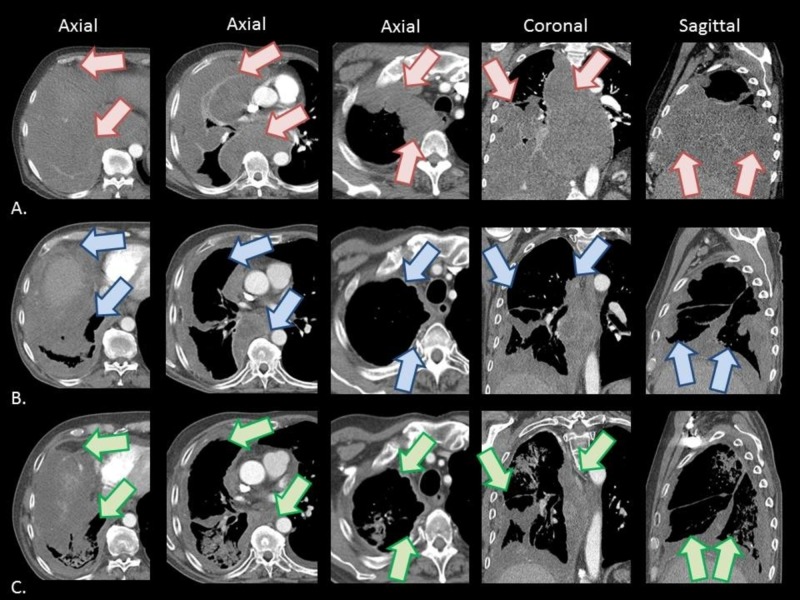 Key image 1