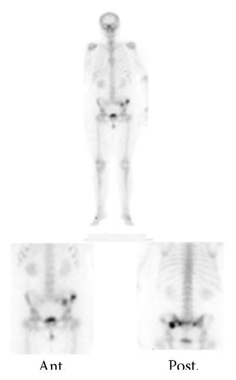 Key image 2