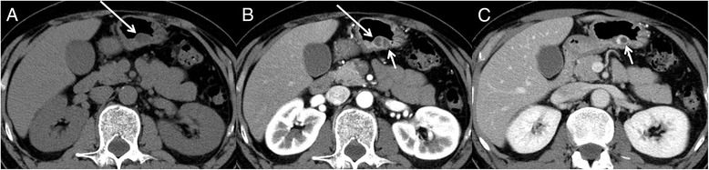 Key image 1