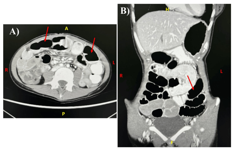 Key image 1