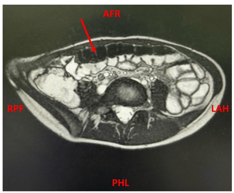 Key image 2