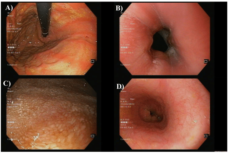 Key image 3