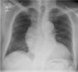 Key image 2