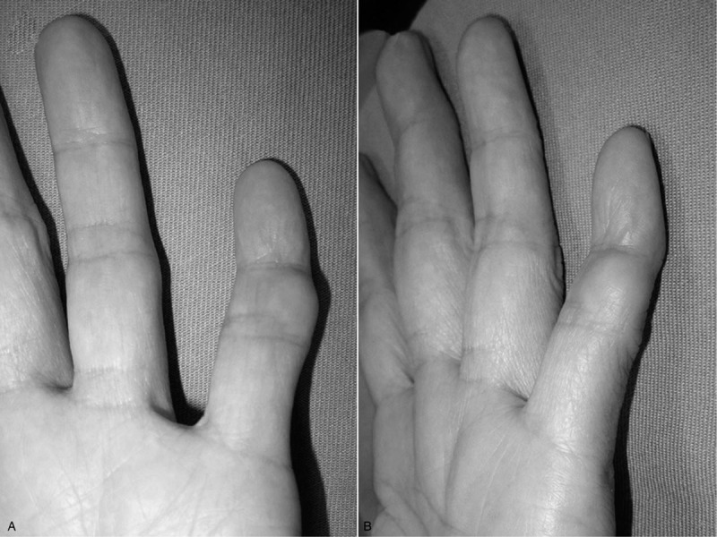Key image 1