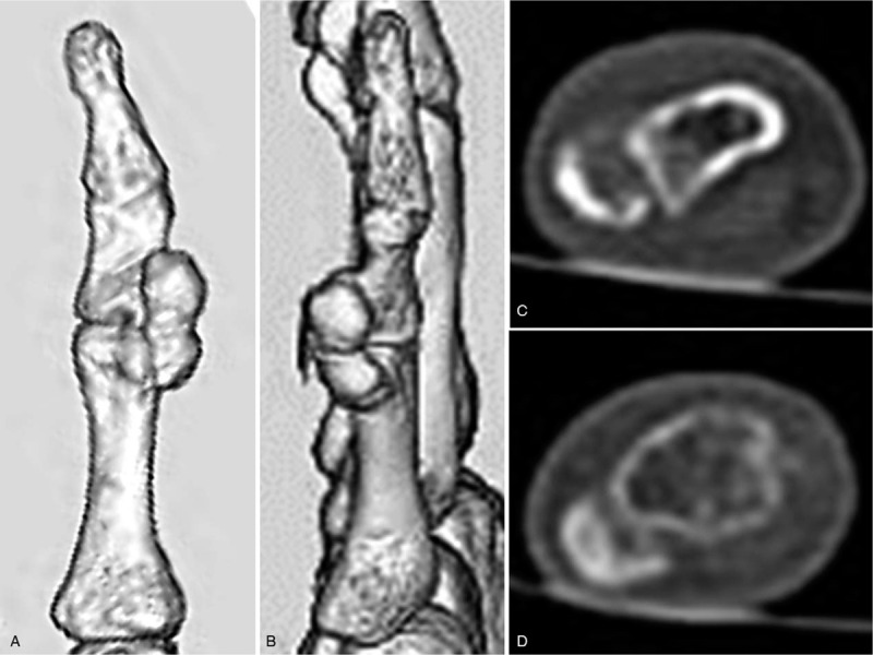Key image 3