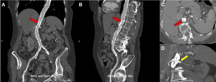 Key image 1