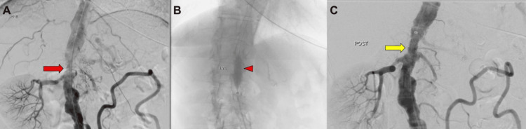 Key image 3