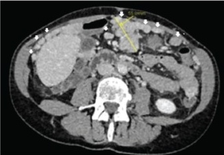 Key image 1