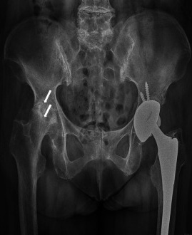 Key image 1