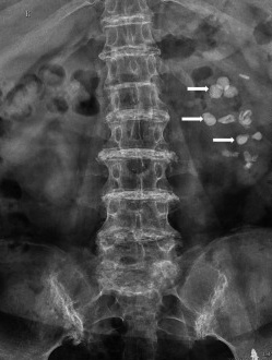 Key image 2