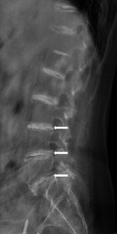 Key image 3