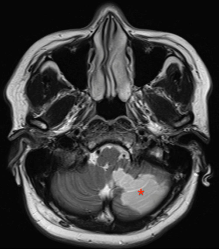 Key image 1