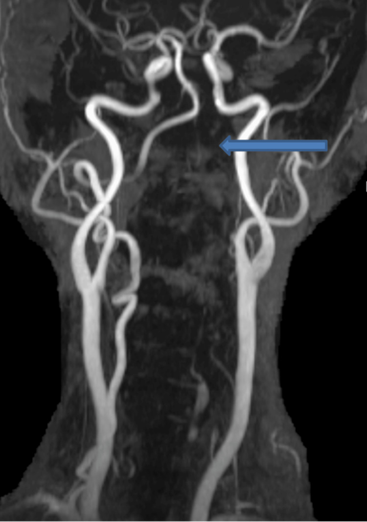 Key image 3