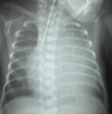Key image 1