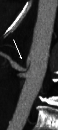 Key image 2
