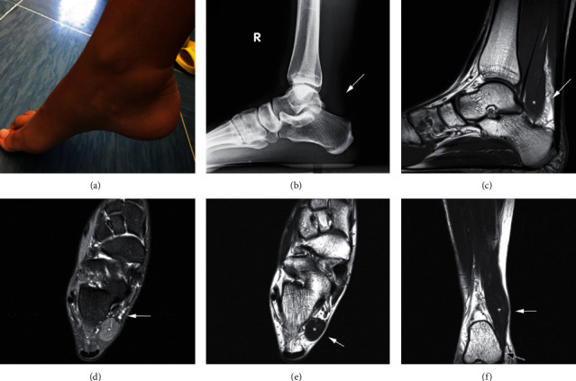 Key image 1