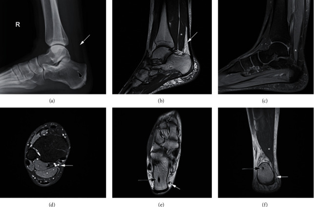 Key image 3