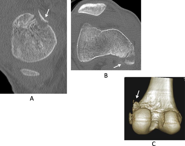 Key image 2