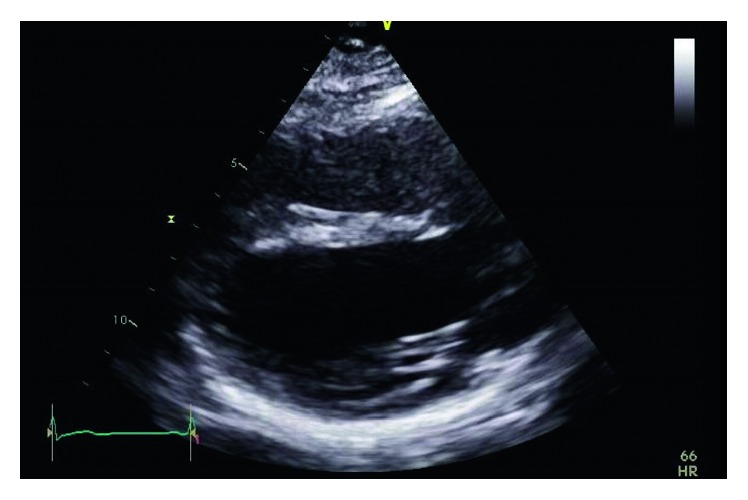 Key image 3