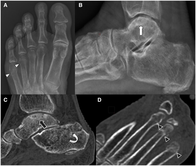 Key image 1