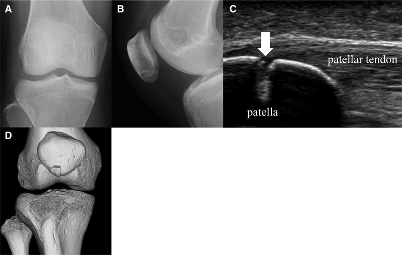 Key image 1