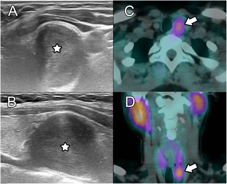 Key image 1