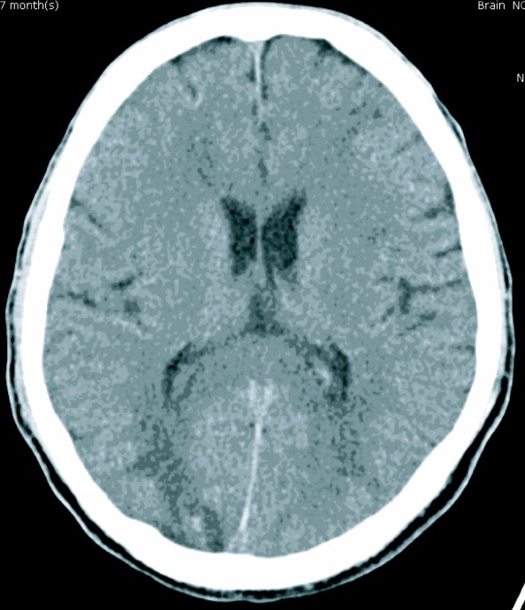 Key image 1