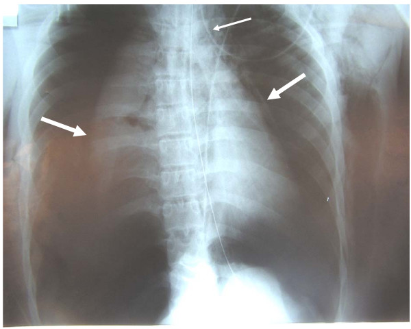 Key image 1