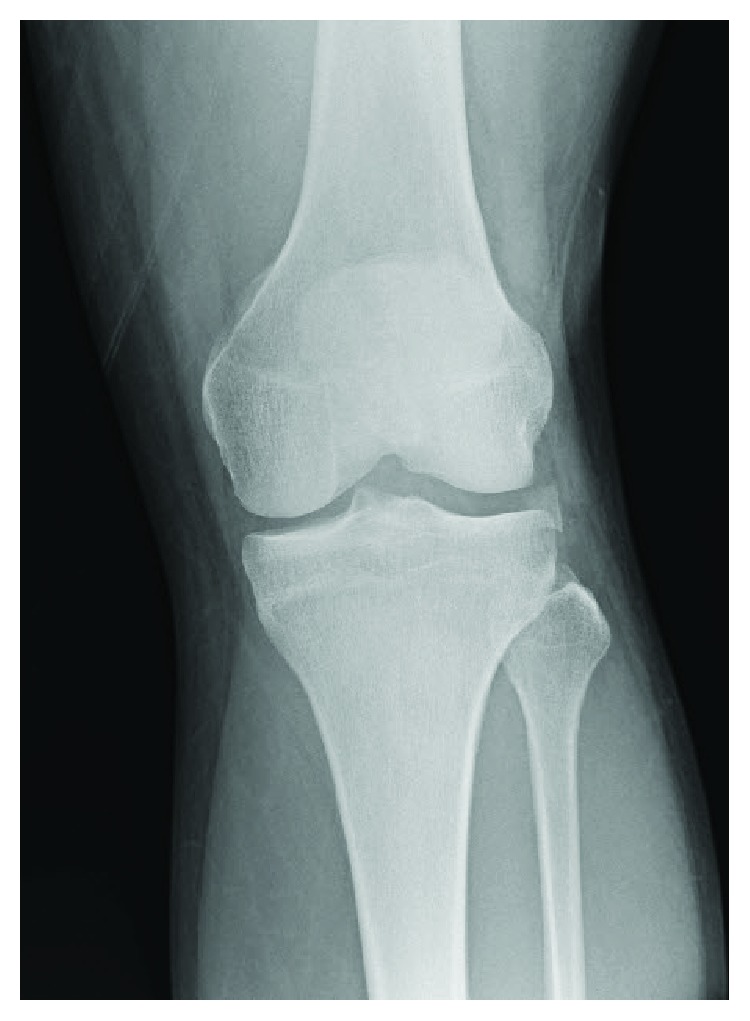 Key image 1