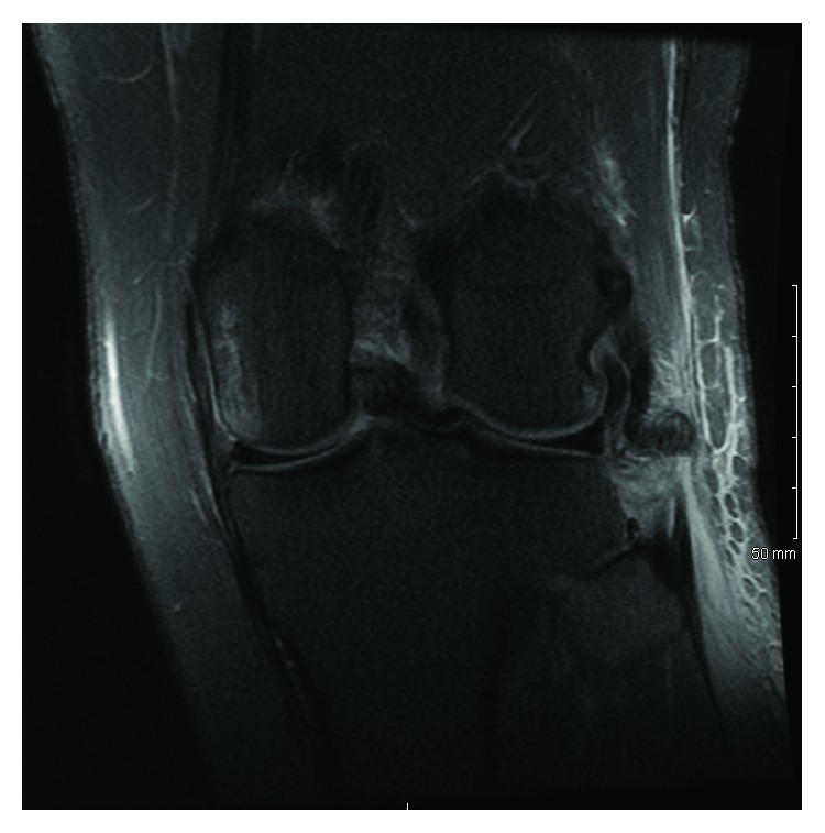 Key image 2