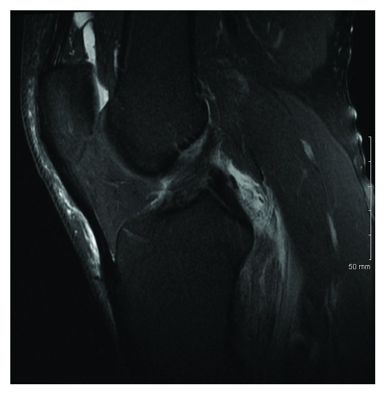 Key image 3