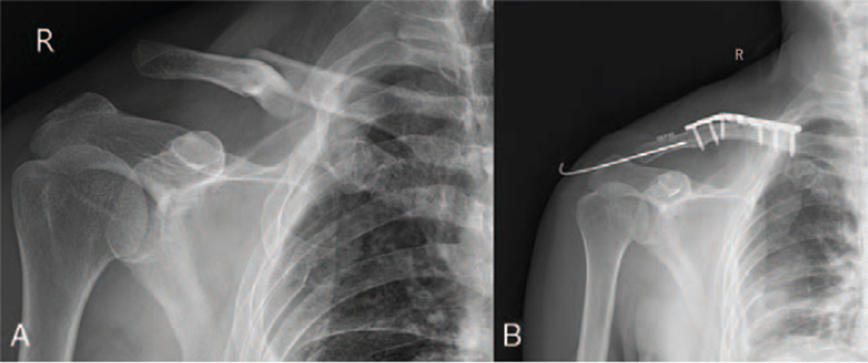 Key image 1