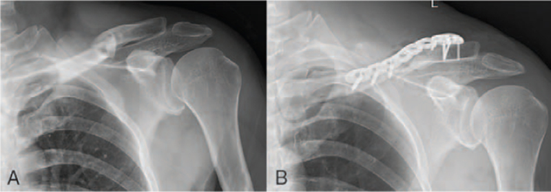 Key image 3