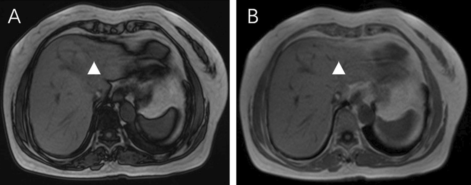 Key image 3