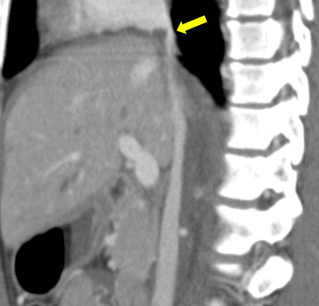 Key image 2