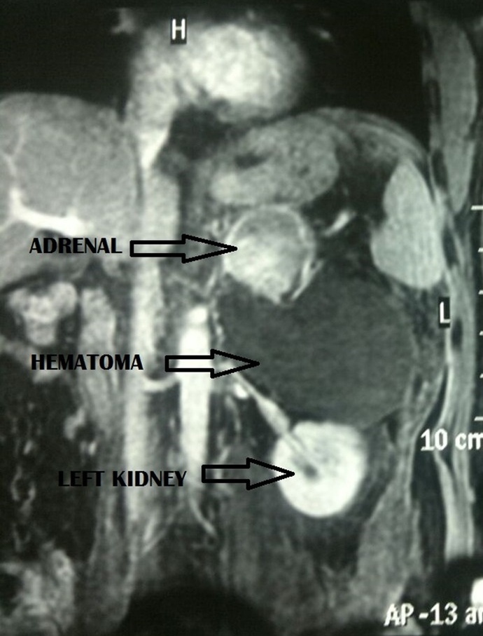 Key image 1