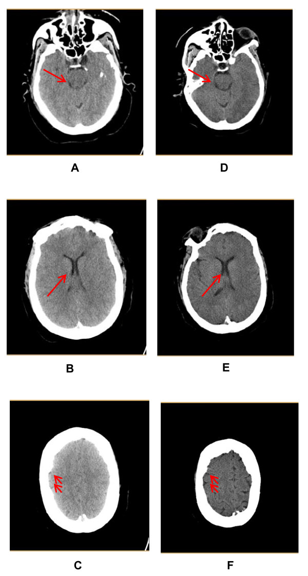 Key image 1