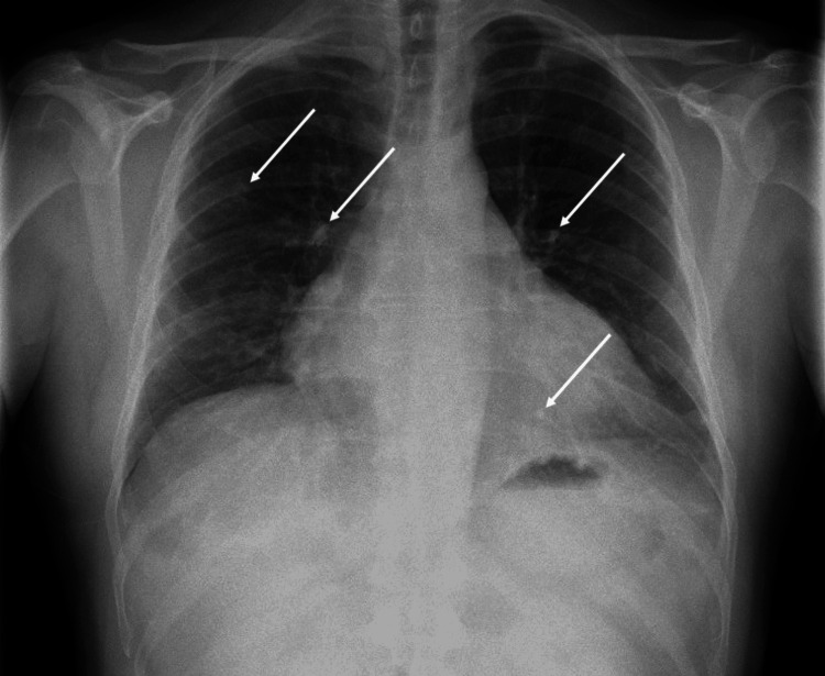 Key image 1