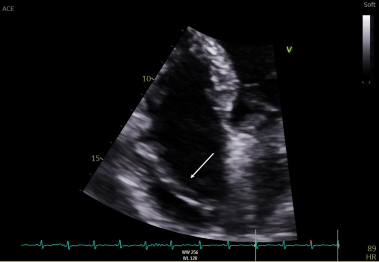 Key image 3