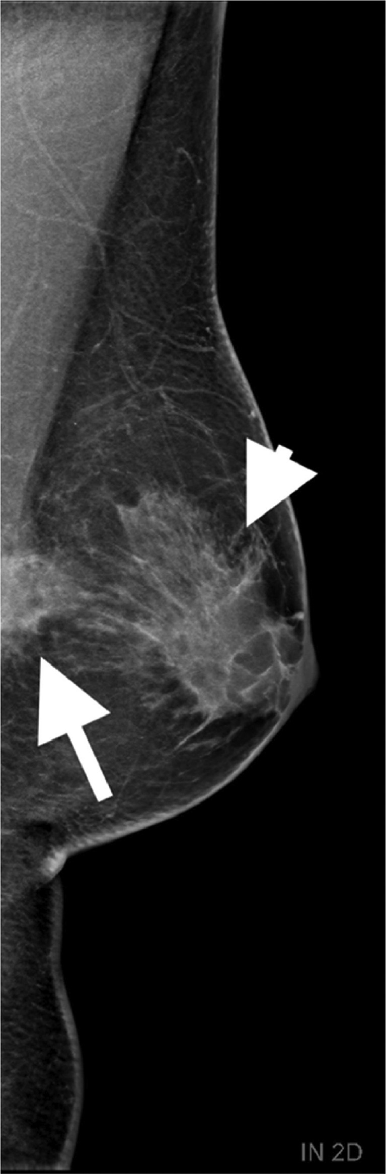 Key image 1