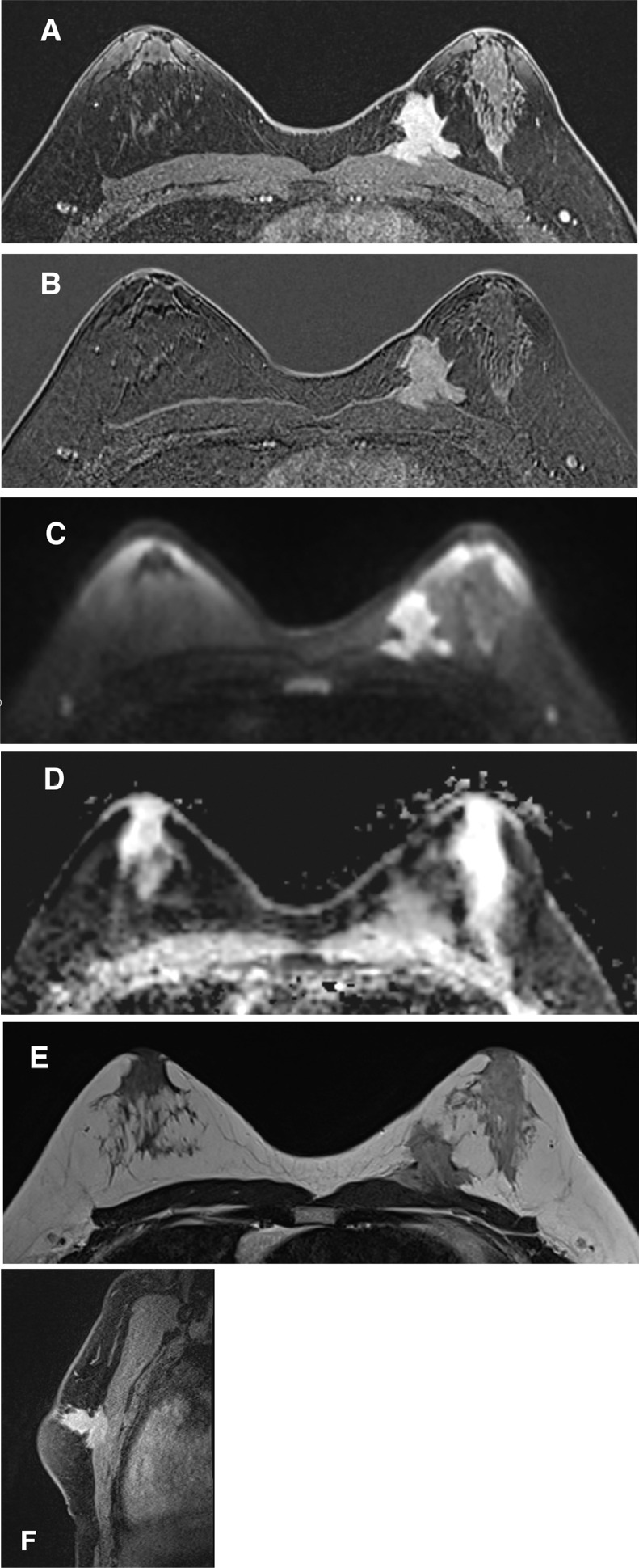 Key image 3